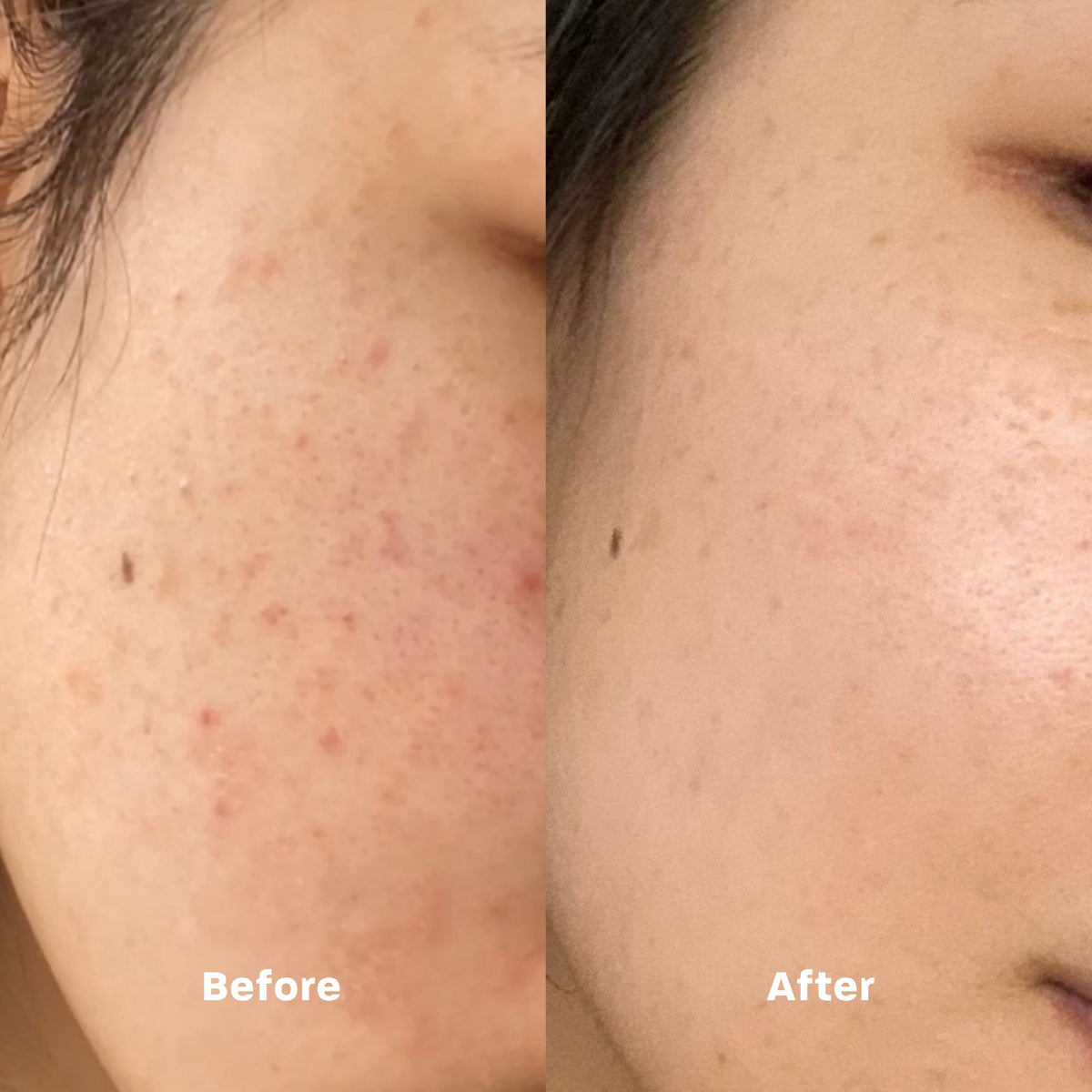 A gentle, hygienic, and eco-friendly cleansing towel that removes makeup and impurities while refreshing and balancing your skin for a radiant glow every day.