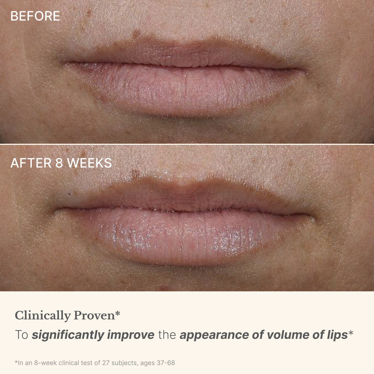 High Performance Lip Filler