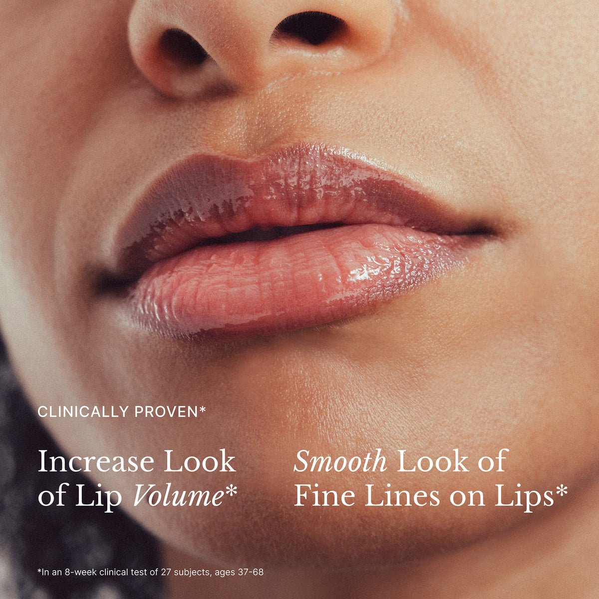 High Performance Lip Filler