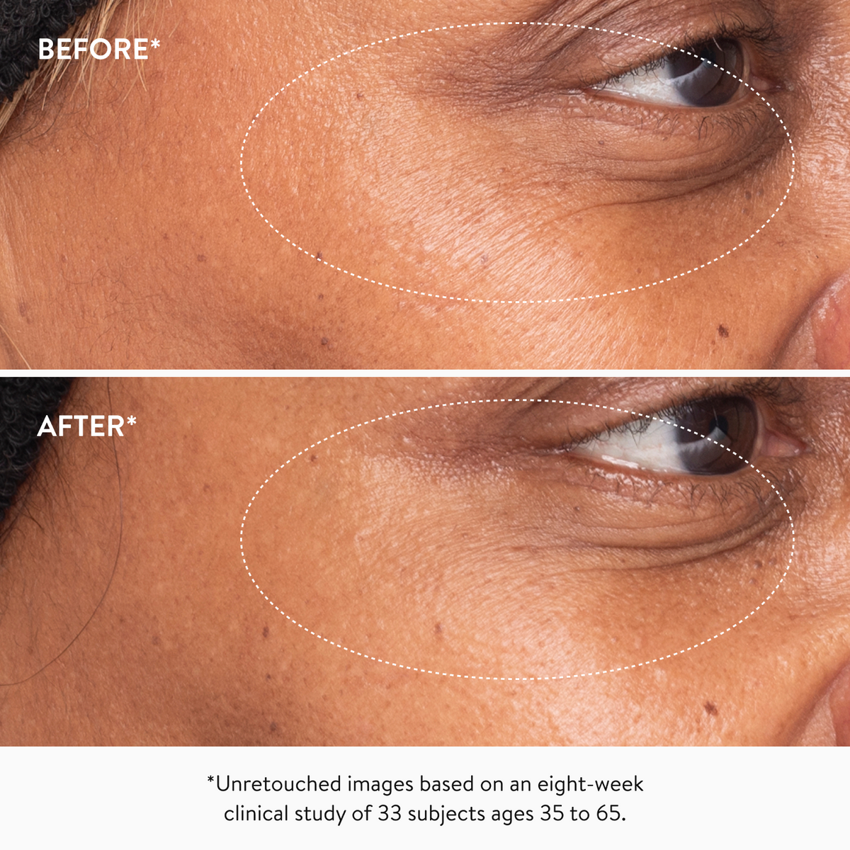 Firming eye serum with triple retinoids to smooth lines, reduce puffiness, and brighten dark circles.