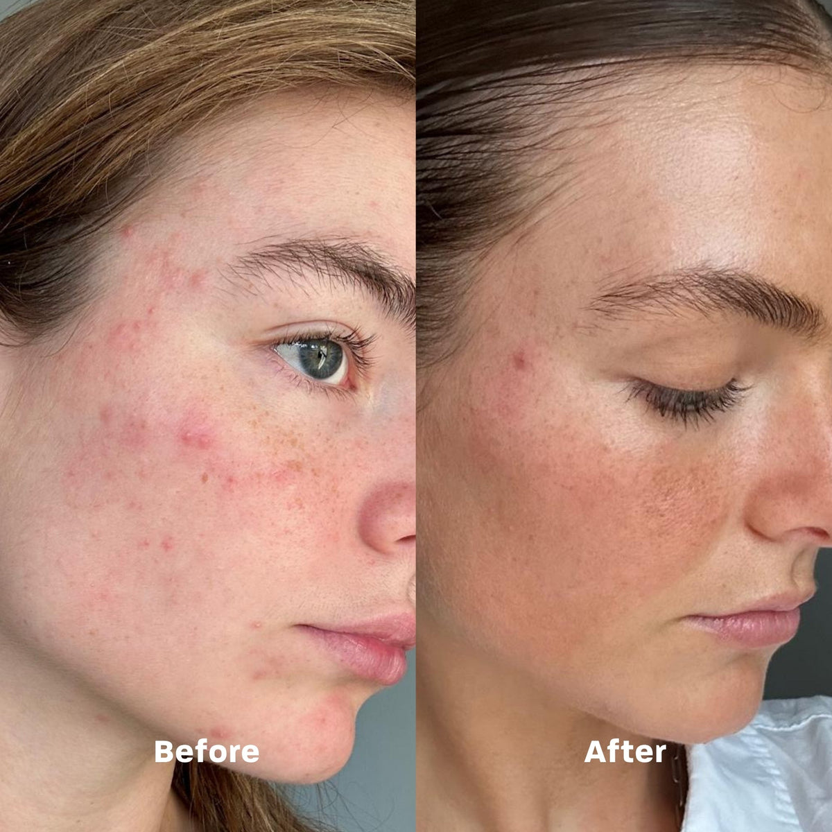 Clarifying LED Mask - FAEVES BY CELESTE