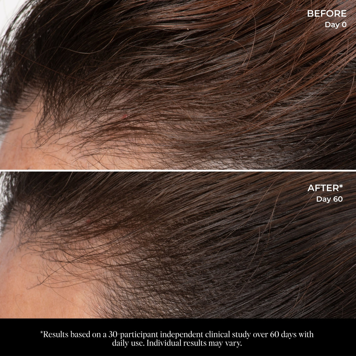 Let There Be Hair Scalp Serum - LolaVie