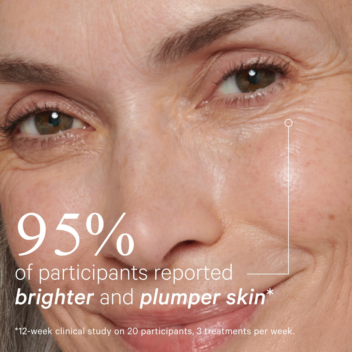 Lightmax MiniPro LED - Thirteen LuneSkincare < ToolsMZ SkinMZSKIN-50505-EYEA device that combines active cosmetics with the power of LED for a supercharged eye-care routine that delivers targeted light-therapy to help reduce dark circles, puffiness and fine lines and wrinkles, under, and around the eyes.