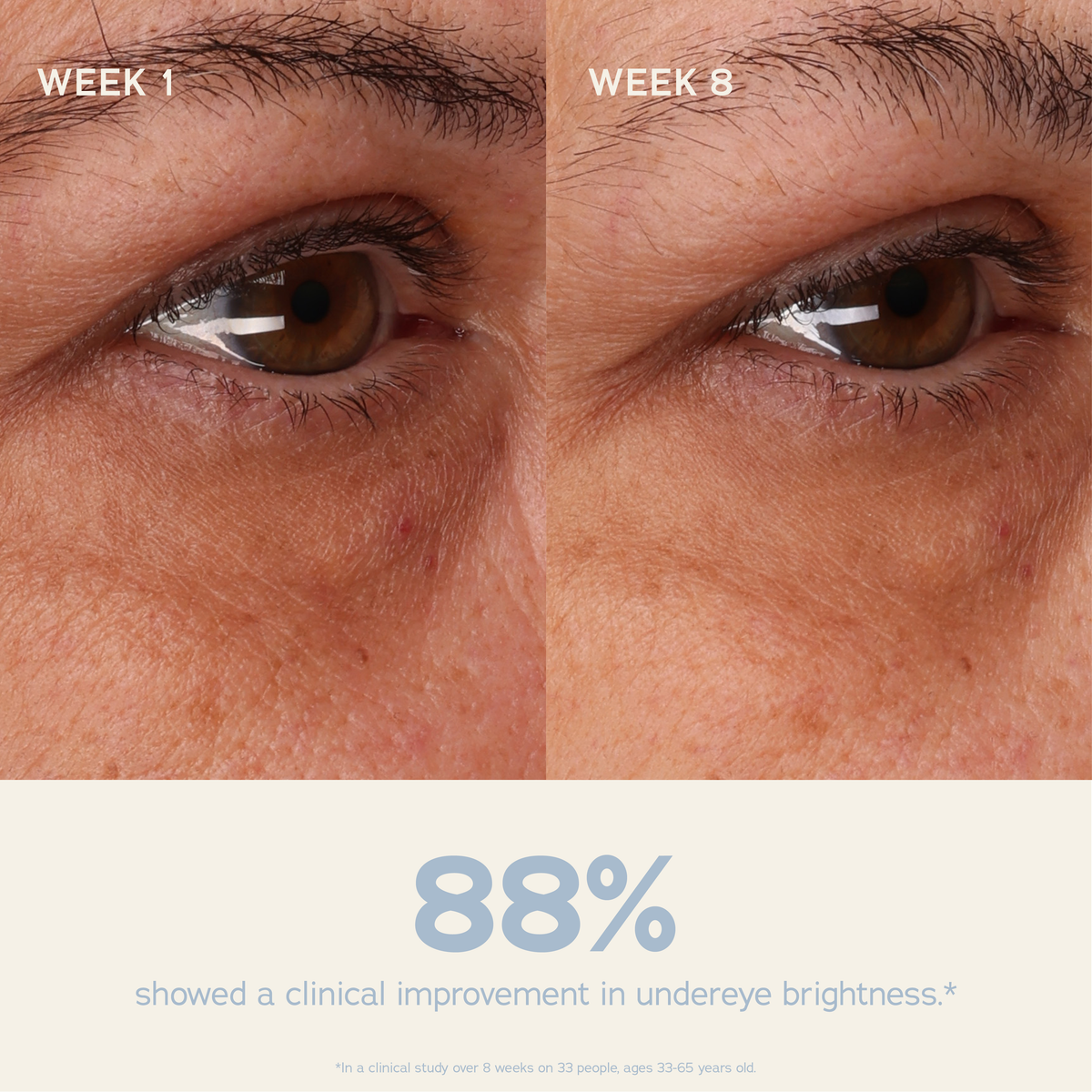 An energizing eye cream with caffeine, peptides, and squalane that reduces puffiness and firms tired skin.