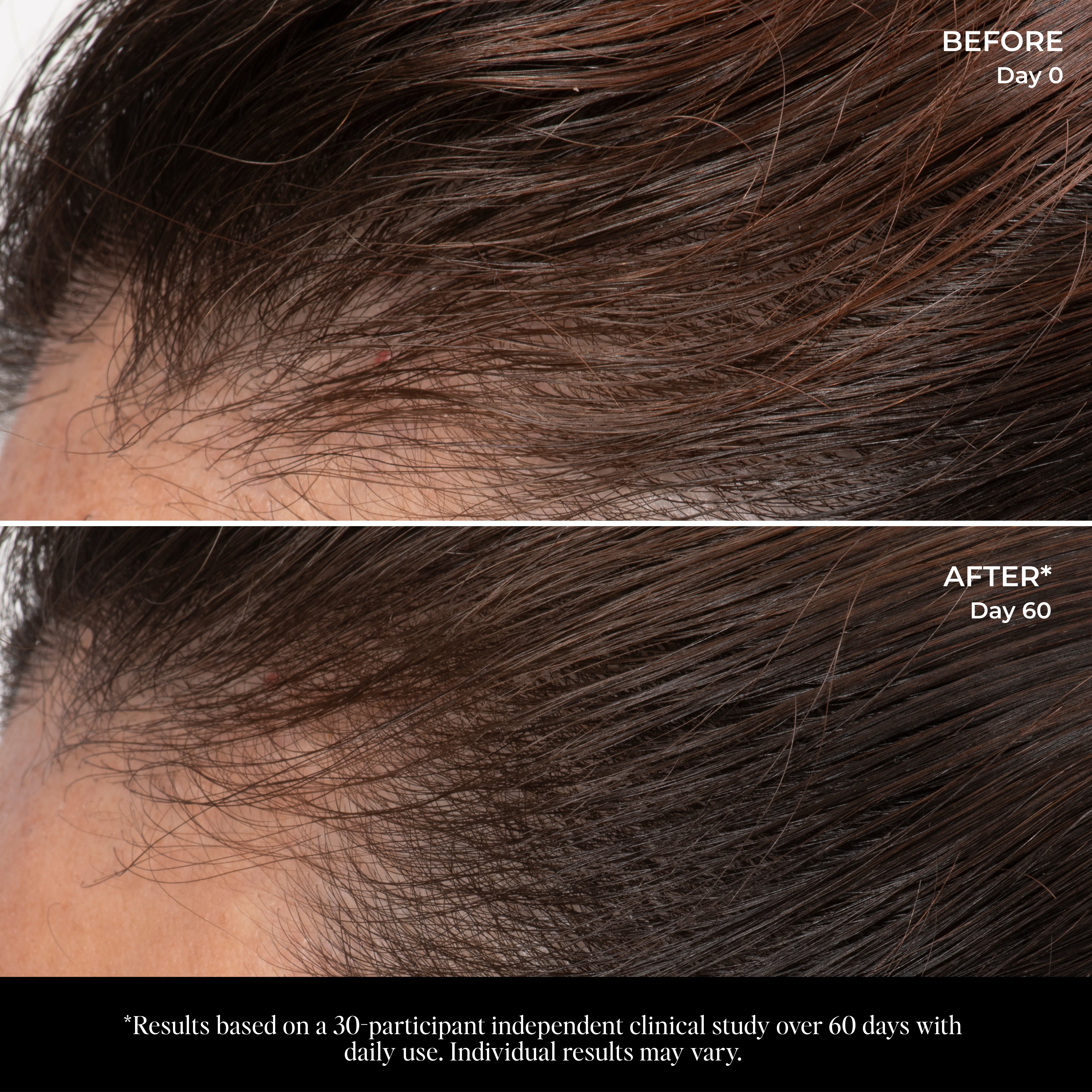 Let There Be Hair Scalp Serum