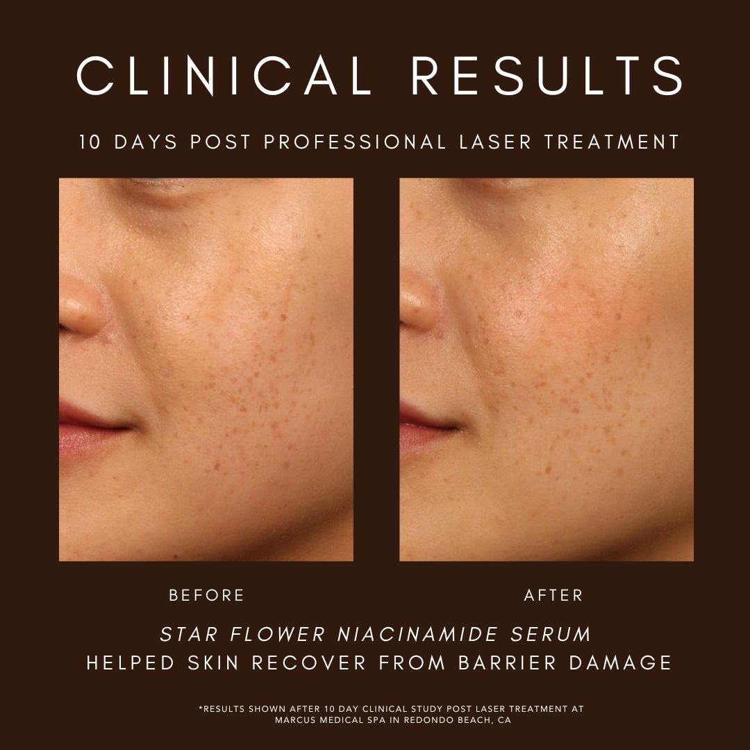 A clinically proven niacinamide serum infused with thousands of golden micro pearls that burst with fresh actives for radiant, hydrated skin.