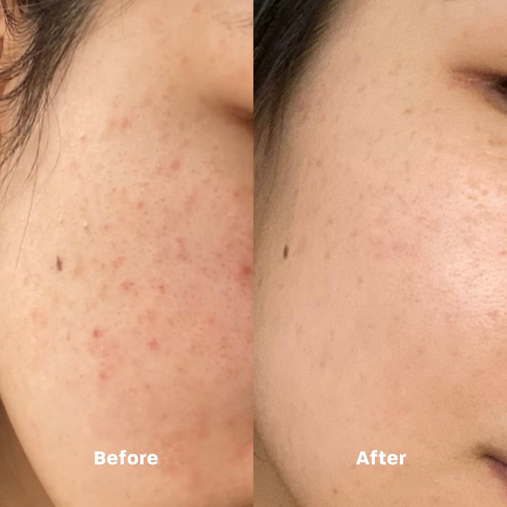 A gentle, hygienic, and eco-friendly cleansing towel that removes makeup and impurities while refreshing and balancing your skin for a radiant glow every day.