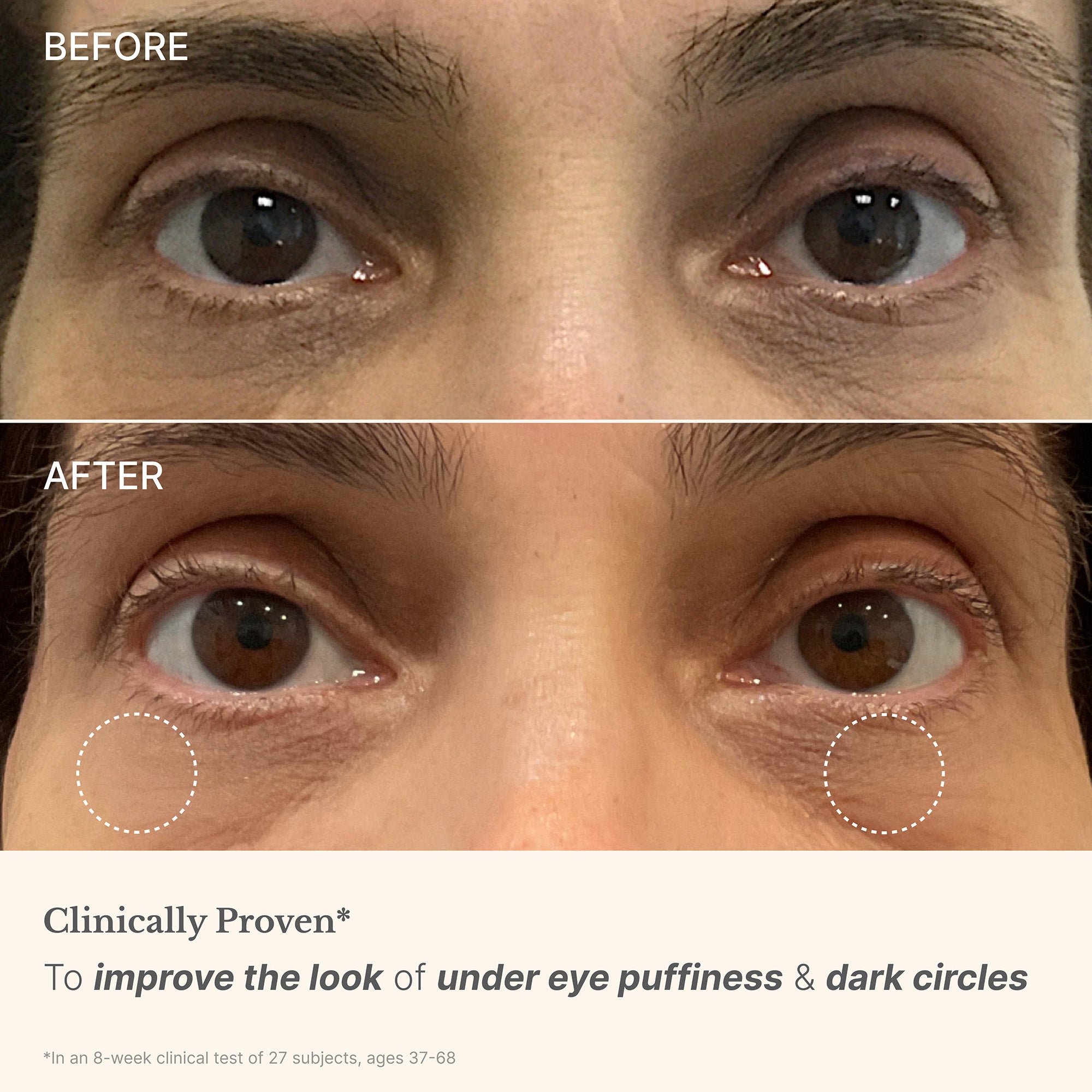 High Performance Eye Cream