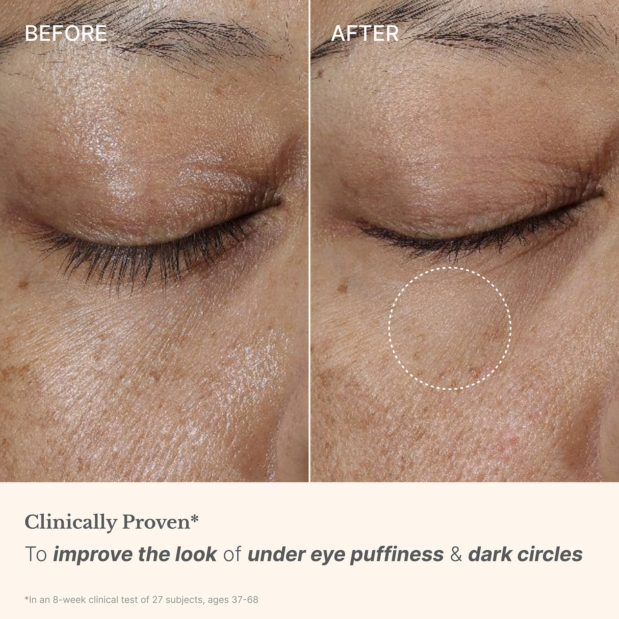 High Performance Eye Cream