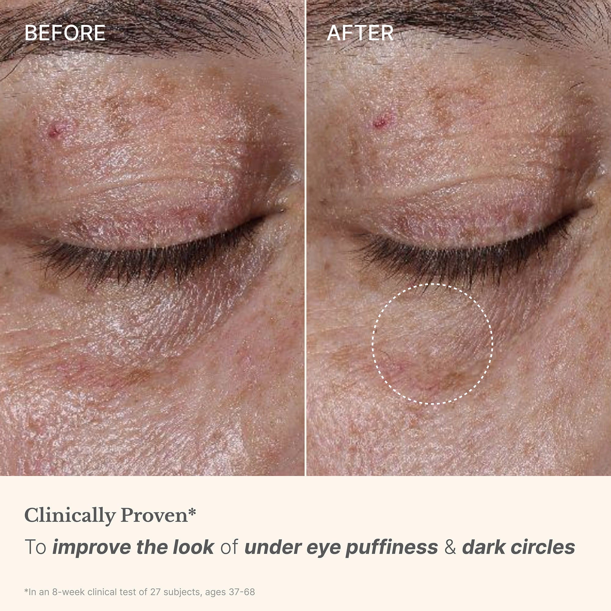 High Performance Eye Cream