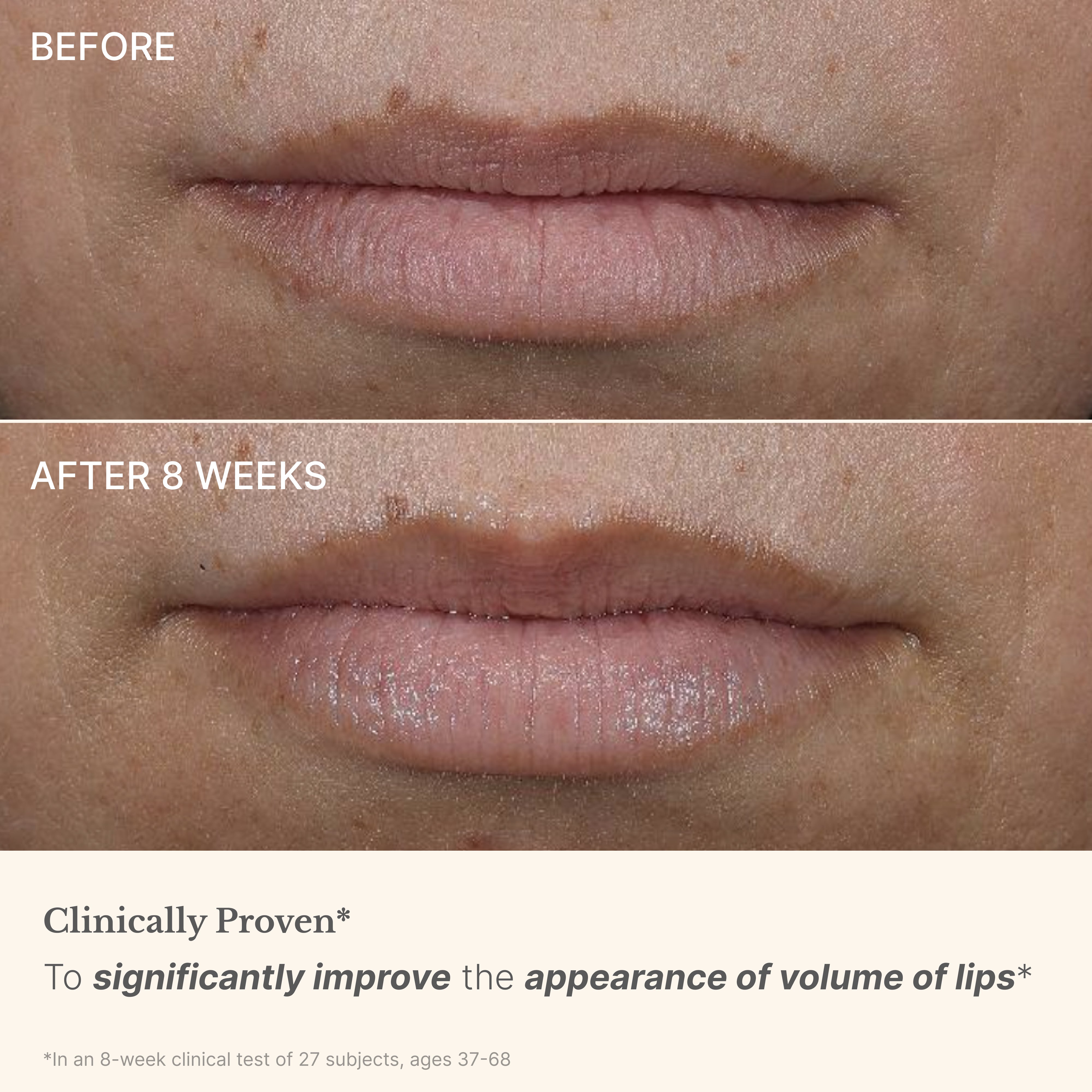 High Performance Lip Filler