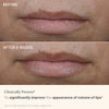 High Performance Lip Filler