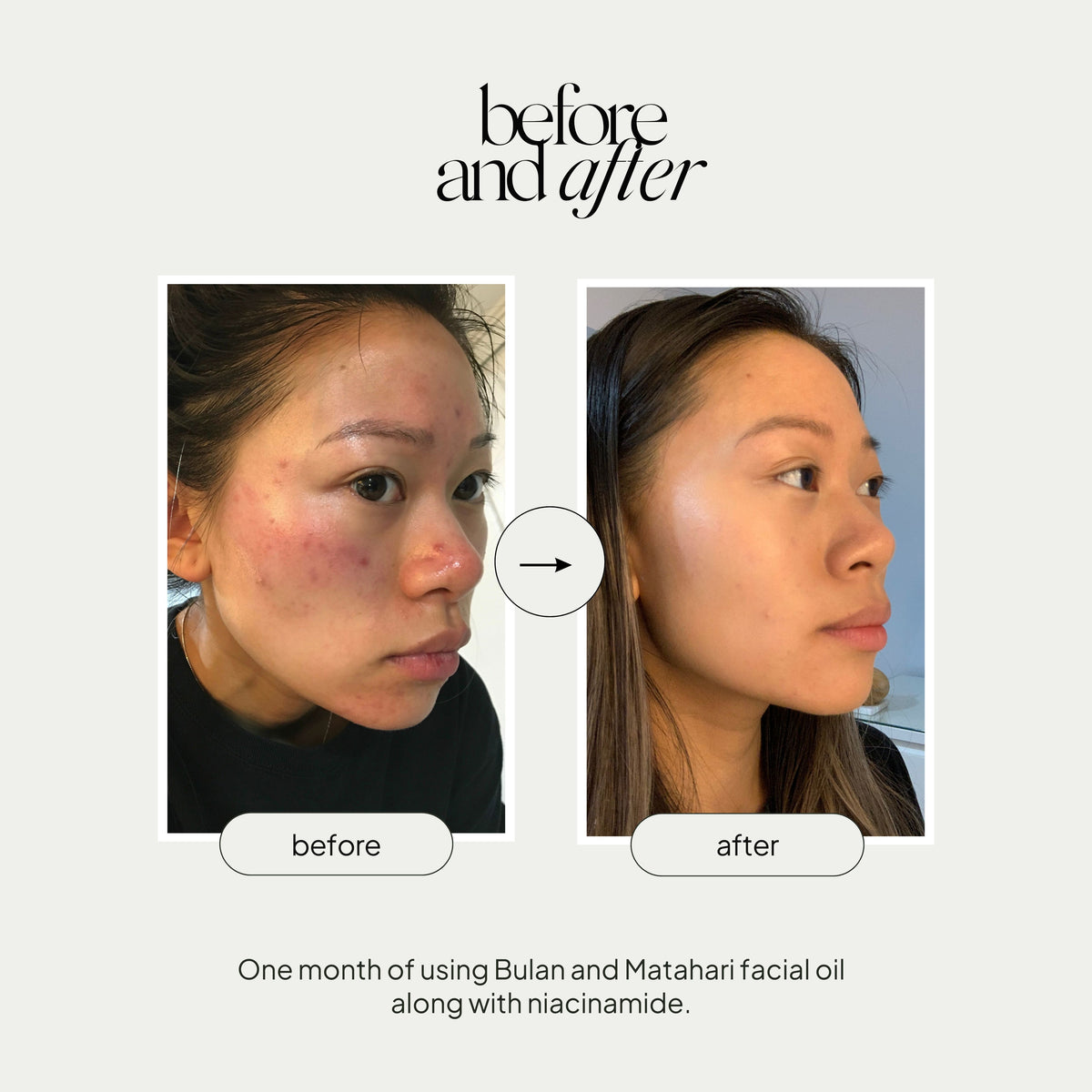 Mini Facial Oil Duo Set