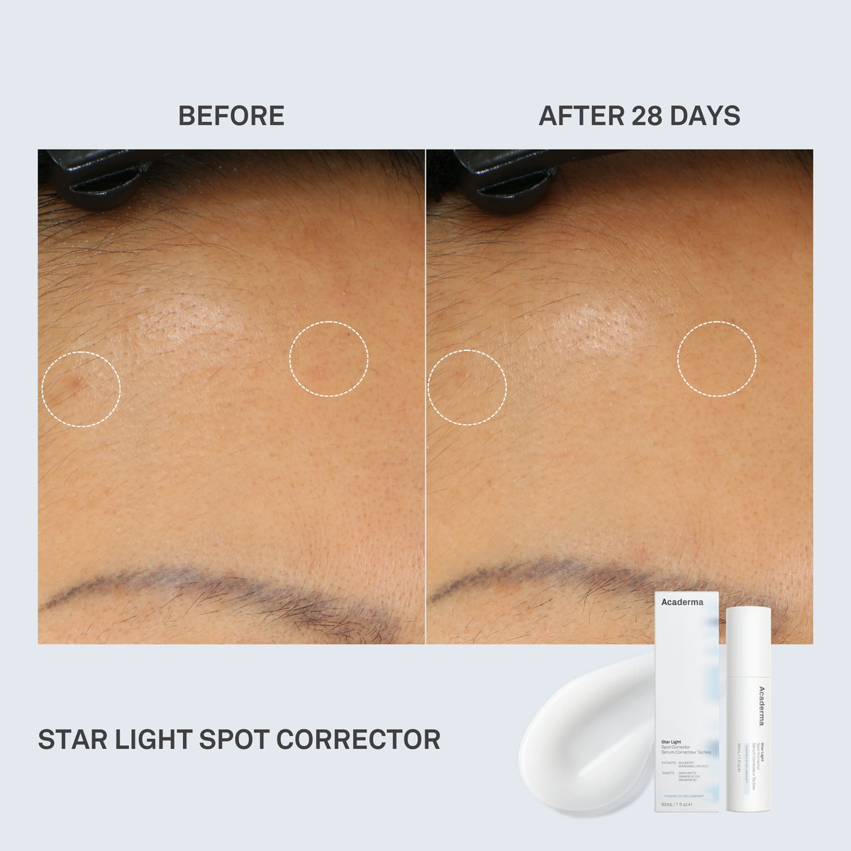 Star Light Spot Corrector Serum 30ml