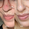 Clarifying LED Patch - FAEVES BY CELESTE