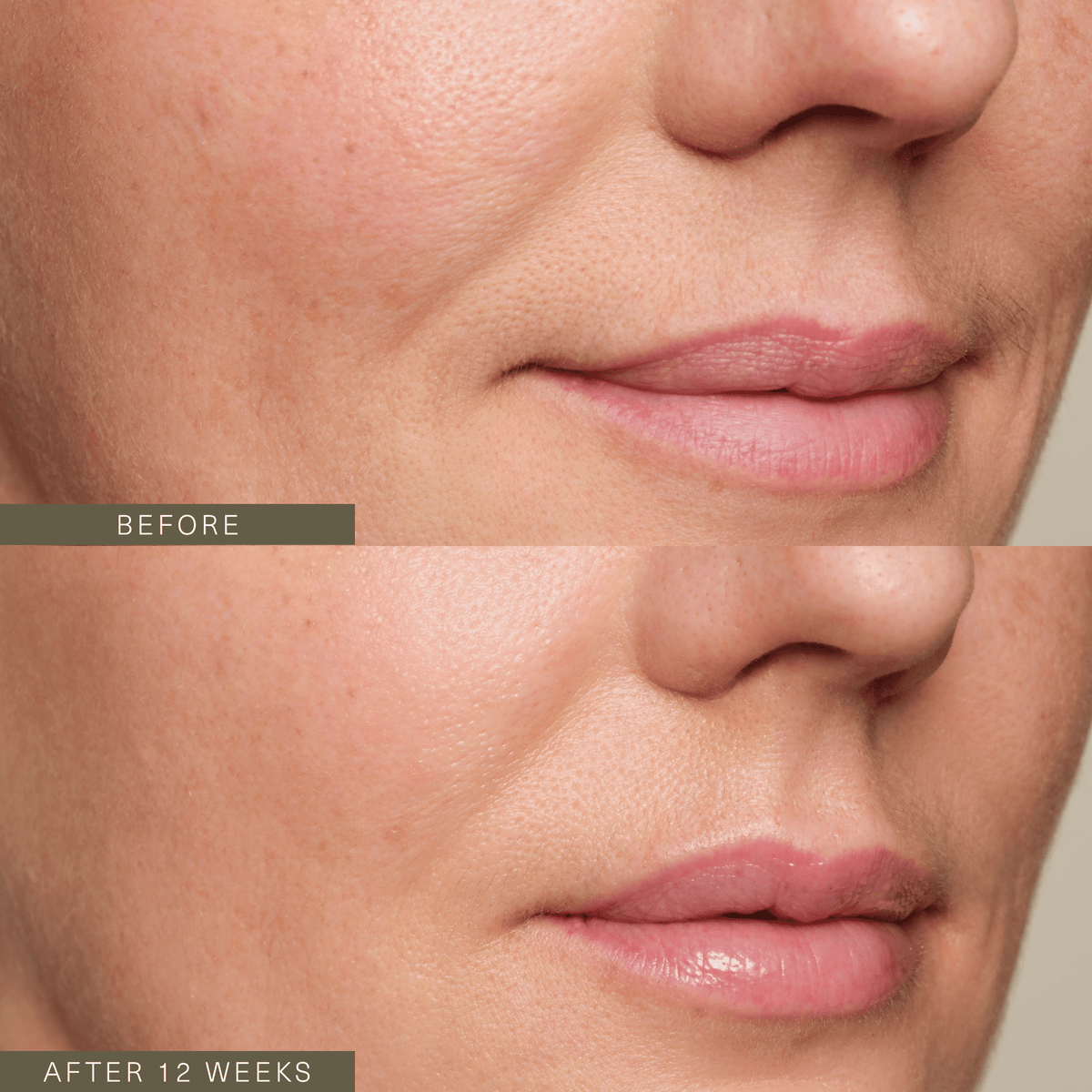 Firming Plant Peptide Serum - Thirteen LuneFaceOak EssentialsOAKESS-FRPEPS-501058Firming Plant Peptide Serum