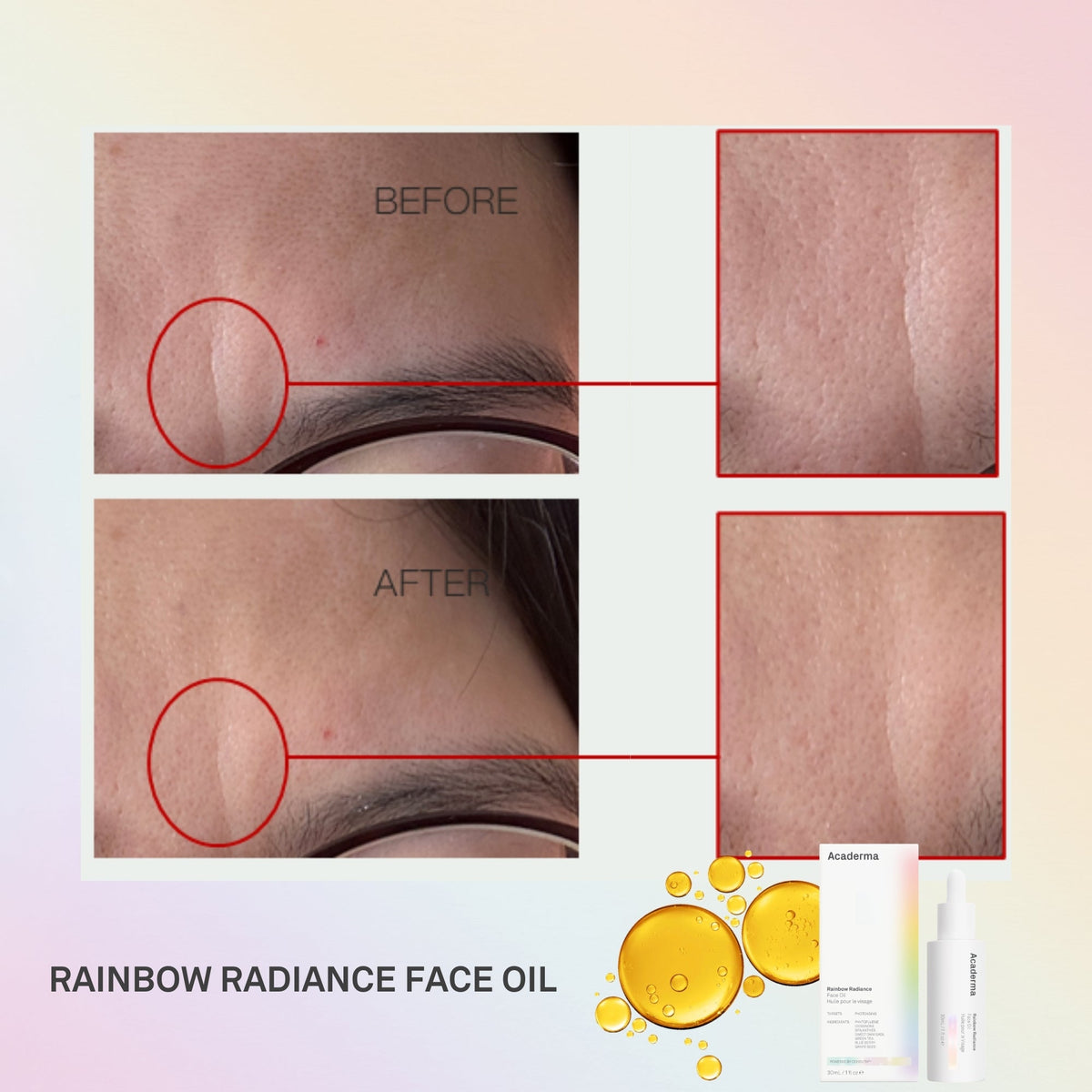 Rainbow Radiance Face Oil 30ml - Acaderma