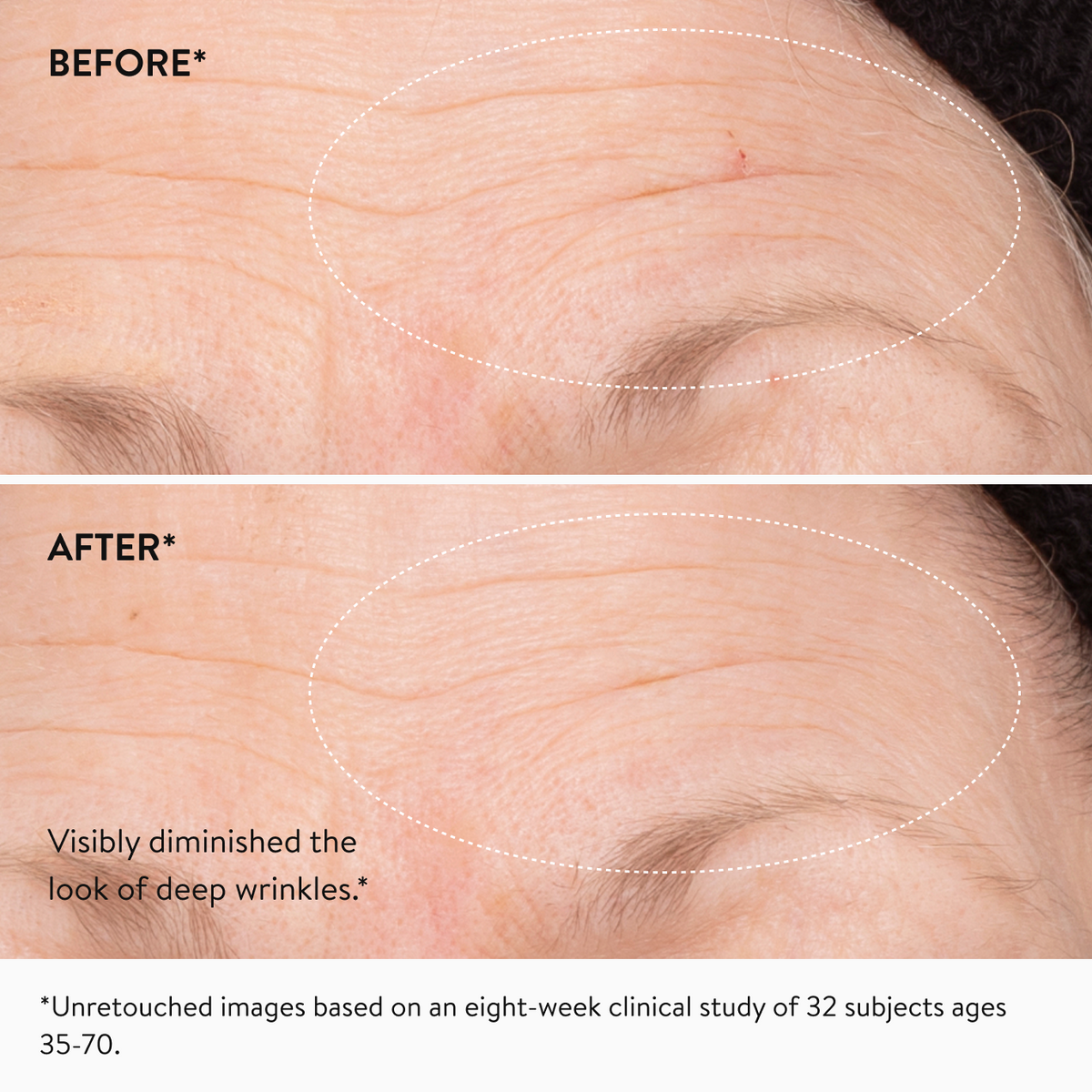Triple-retinoid serum with peptides visibly smooths wrinkles, improves texture, and firms skin with powerful results and minimal irritation.