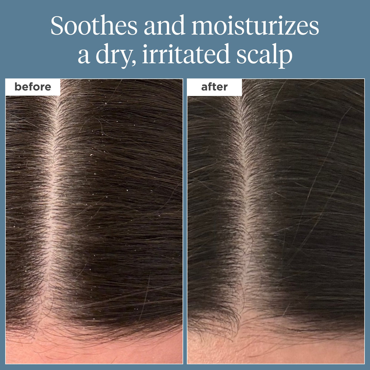 Scalp Revival™ Rosemary Pre-Wash Oil for Hair and Scalp - Briogeo