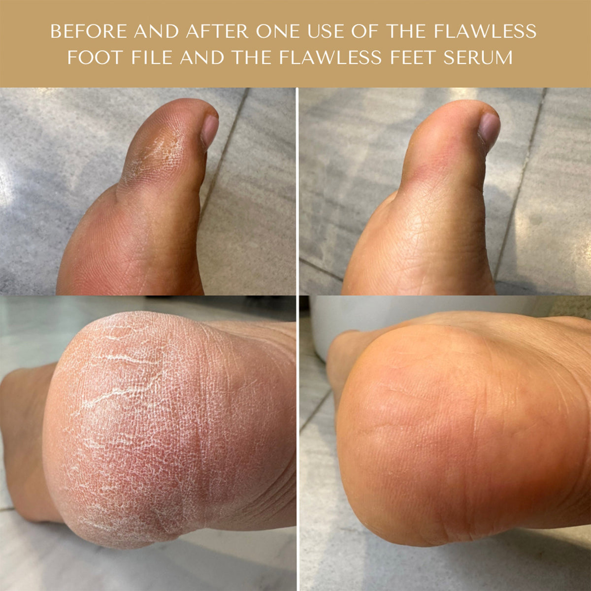 The Flawless Feet Serum - Serum Doctor