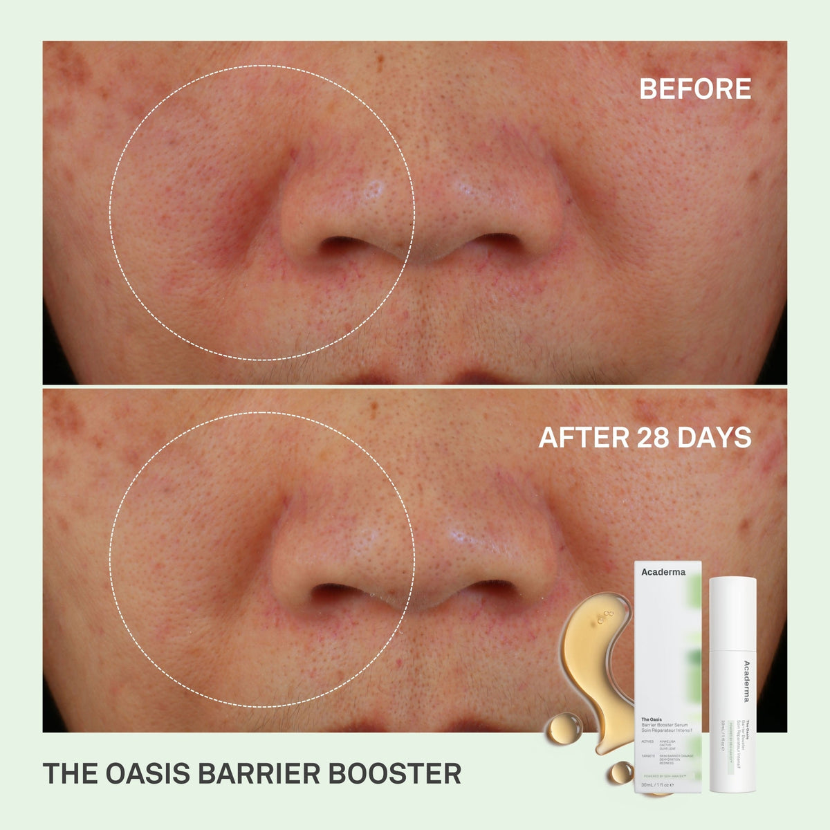 The Oasis Barrier Booster Serum 10ml - Acaderma