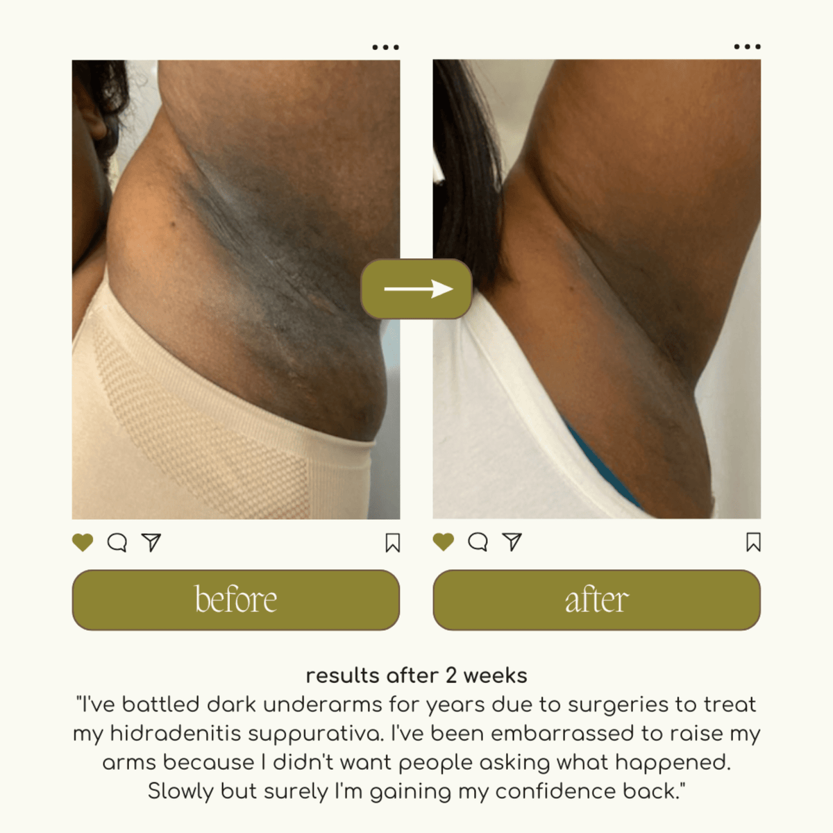 The Original Underarm Brightening Deodorant Cream - Forgotten Skincare