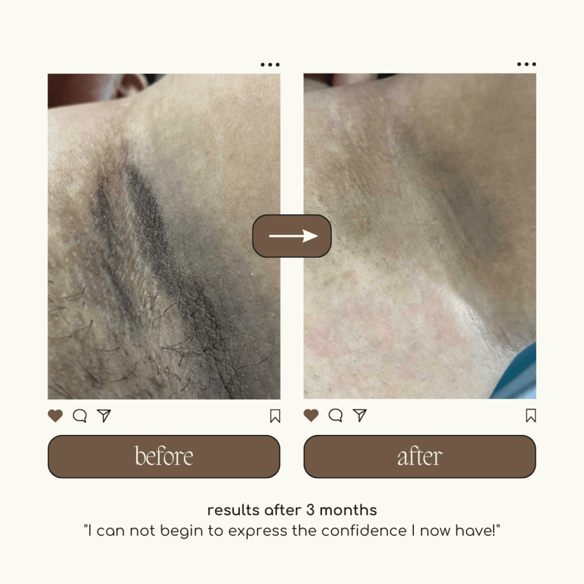 The Original Underarm Brightening Deodorant Cream - Forgotten Skincare