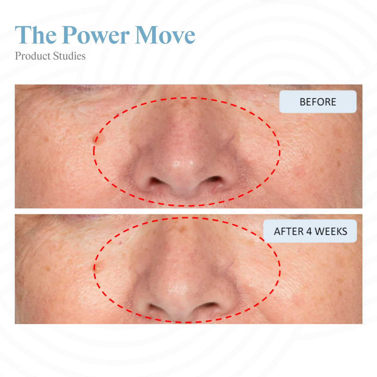 The Power Move - Plumping & Hydrating Face Serum - Stripes
