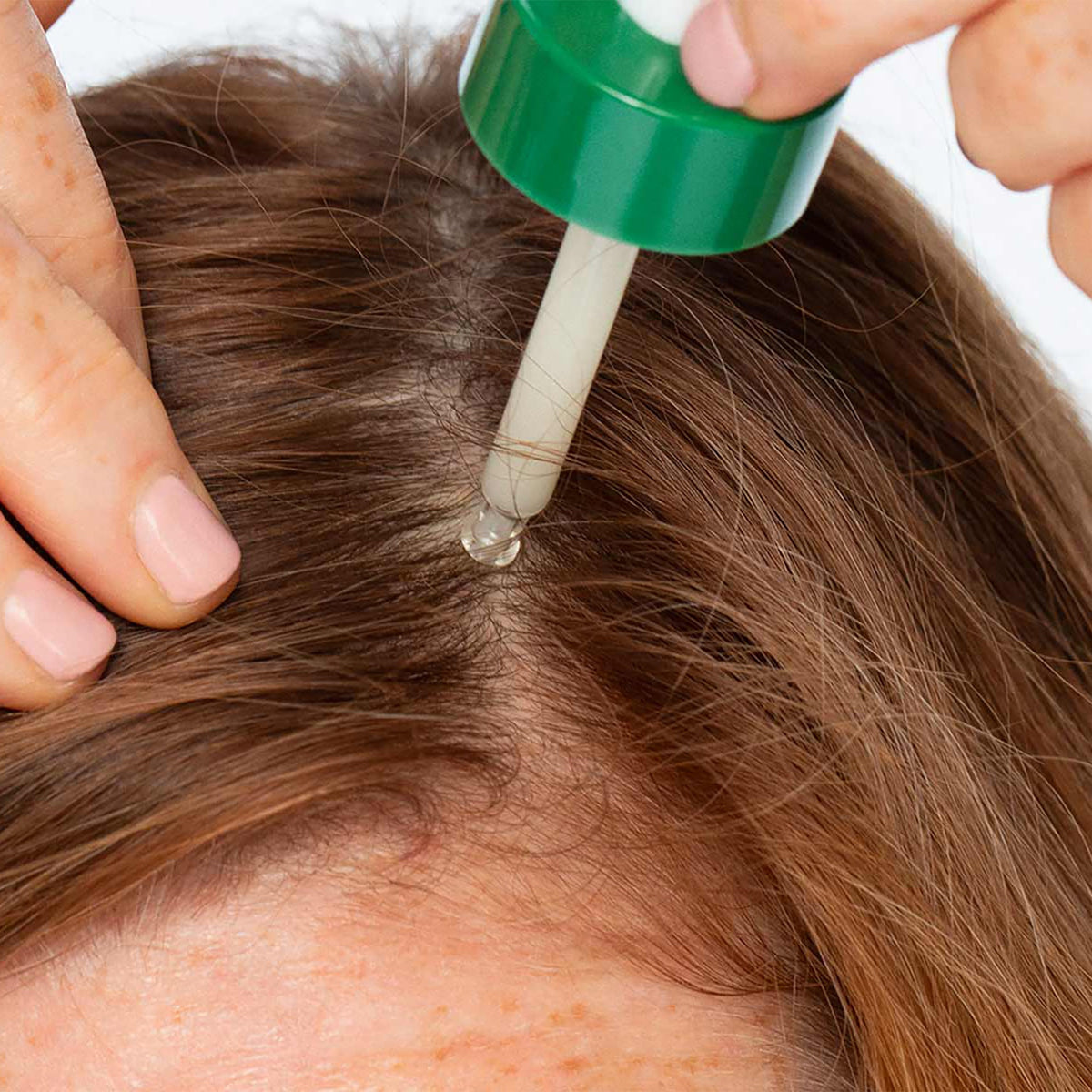 The Root Of It - Hydrating & Thickening Scalp Serum - Stripes