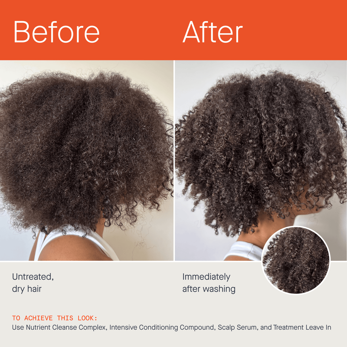 Treatment Leave-In - OurX